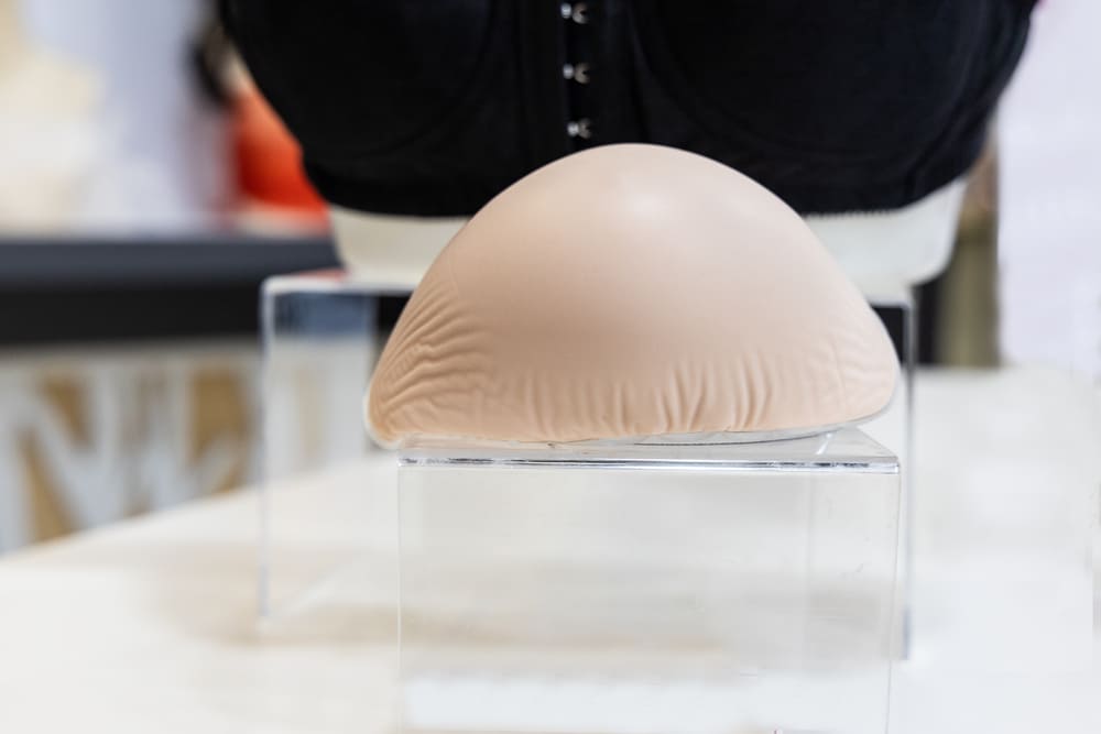 mamoplastia de aumento