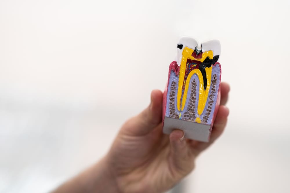 Cuándo buscar especialistas en endodoncia en Panamá
