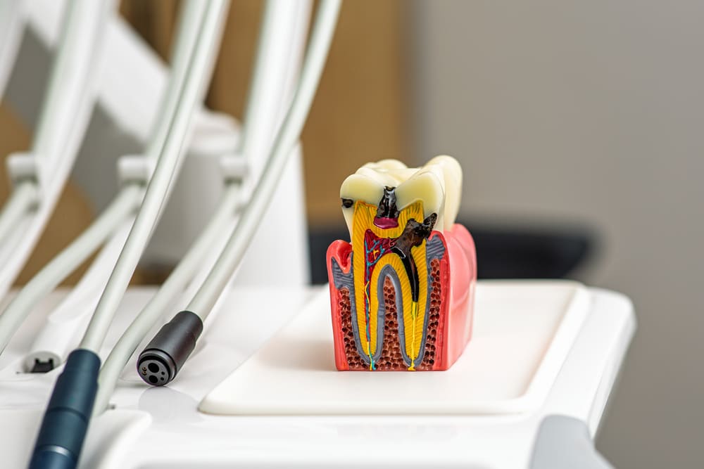 Endodoncia en Panamá: una alternativa frente a la extracción dental