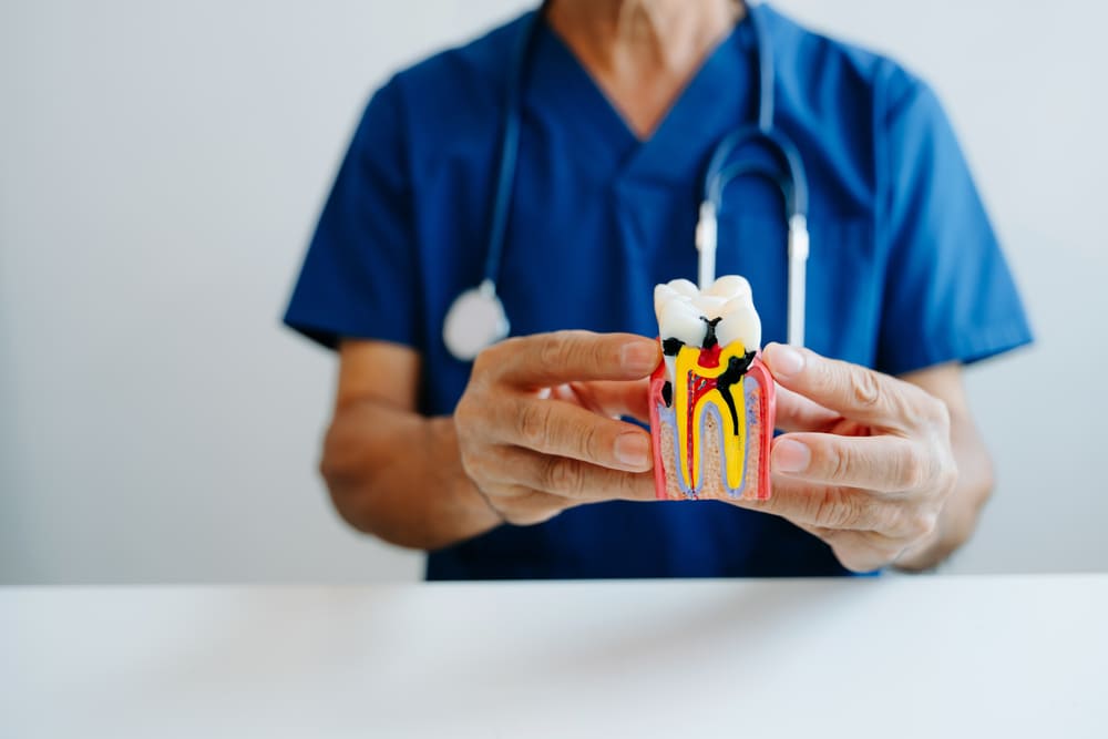 Endodoncia: la mejor solución en Panamá