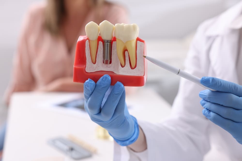 Endodoncia: una alternativa para salvar dientes en Panamá