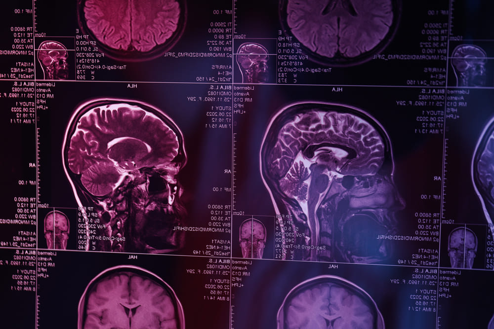 Neuro Leaders Forum en Guatemala es un espacio para compartir conocimientos especializados