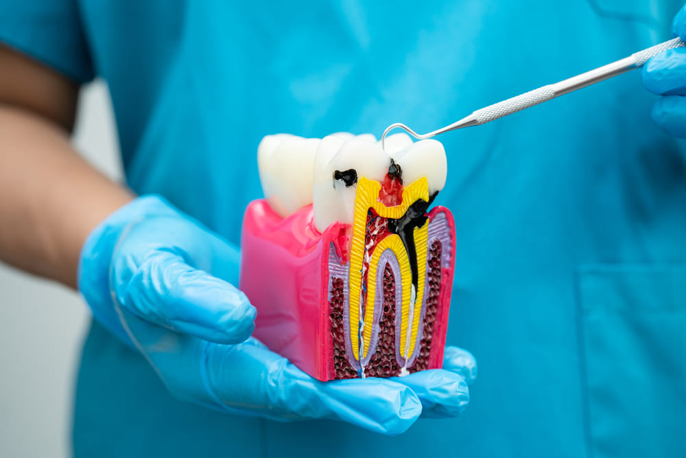 Cuándo acudir a un especialista en periodoncia en Panamá para evitar complicaciones